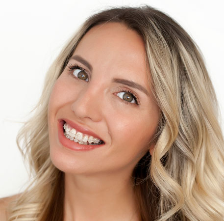 blonde woman smiling with braces