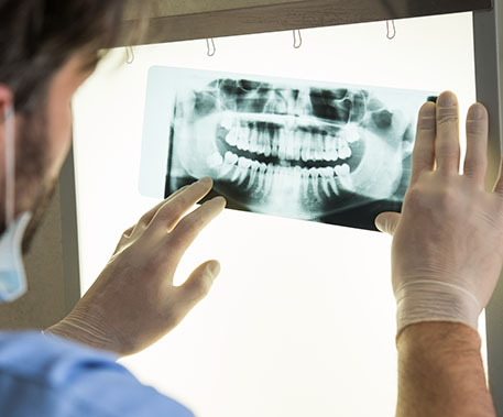 a dental x-ray